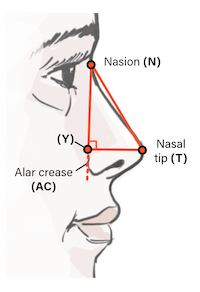 Crumley and Lanser Method